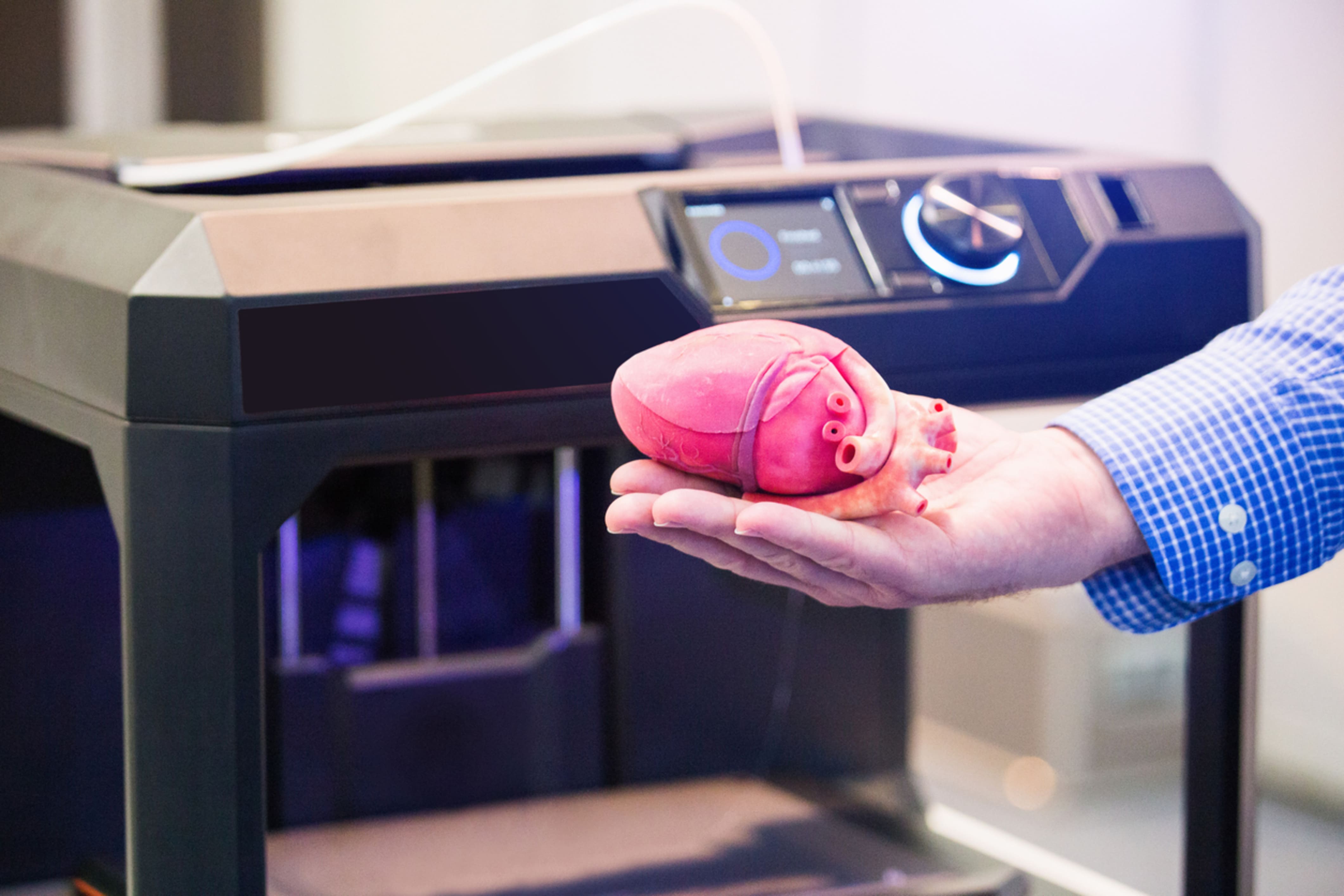 3D Printers in the Medical Environment